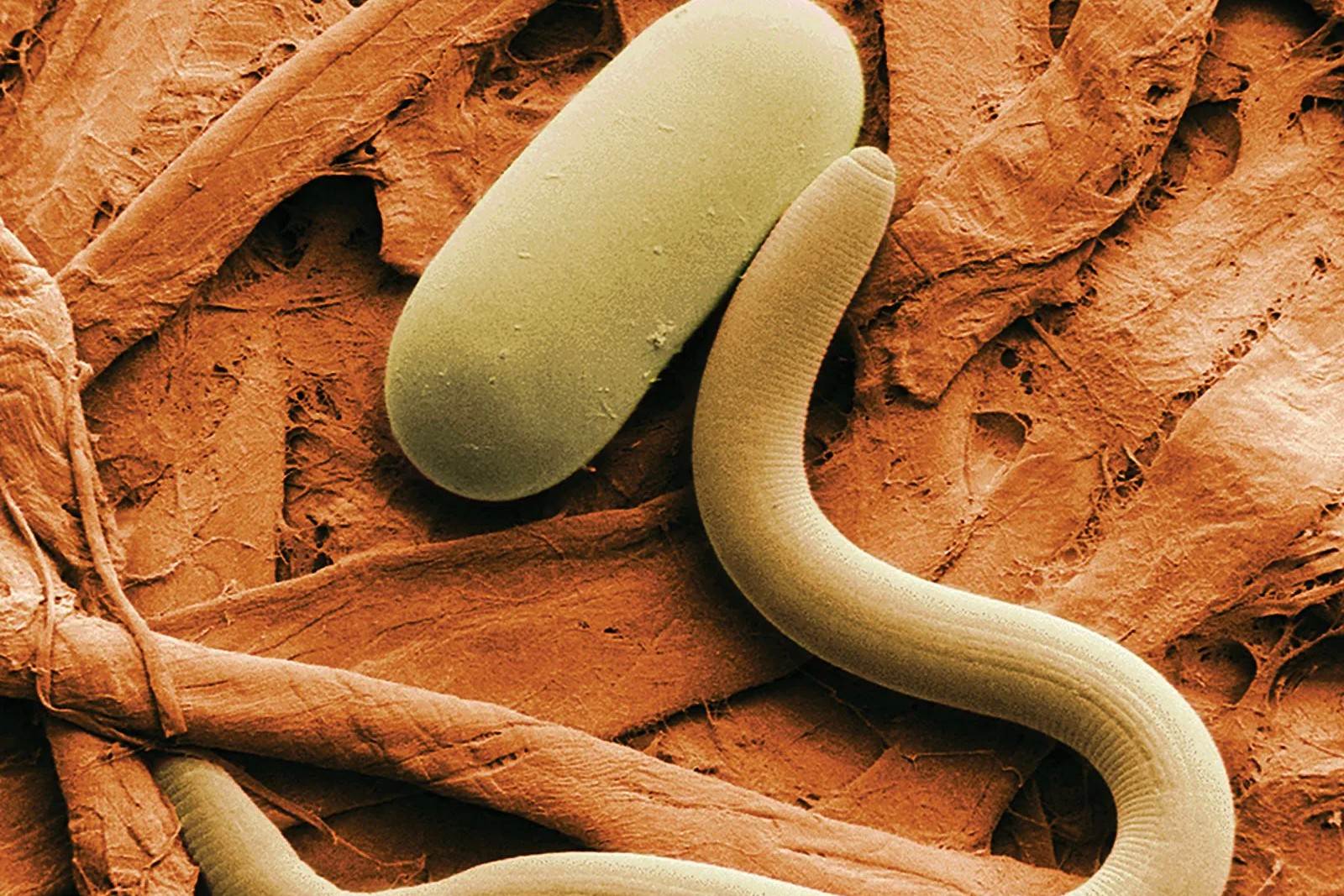 26 Fakta Om Nematoder
