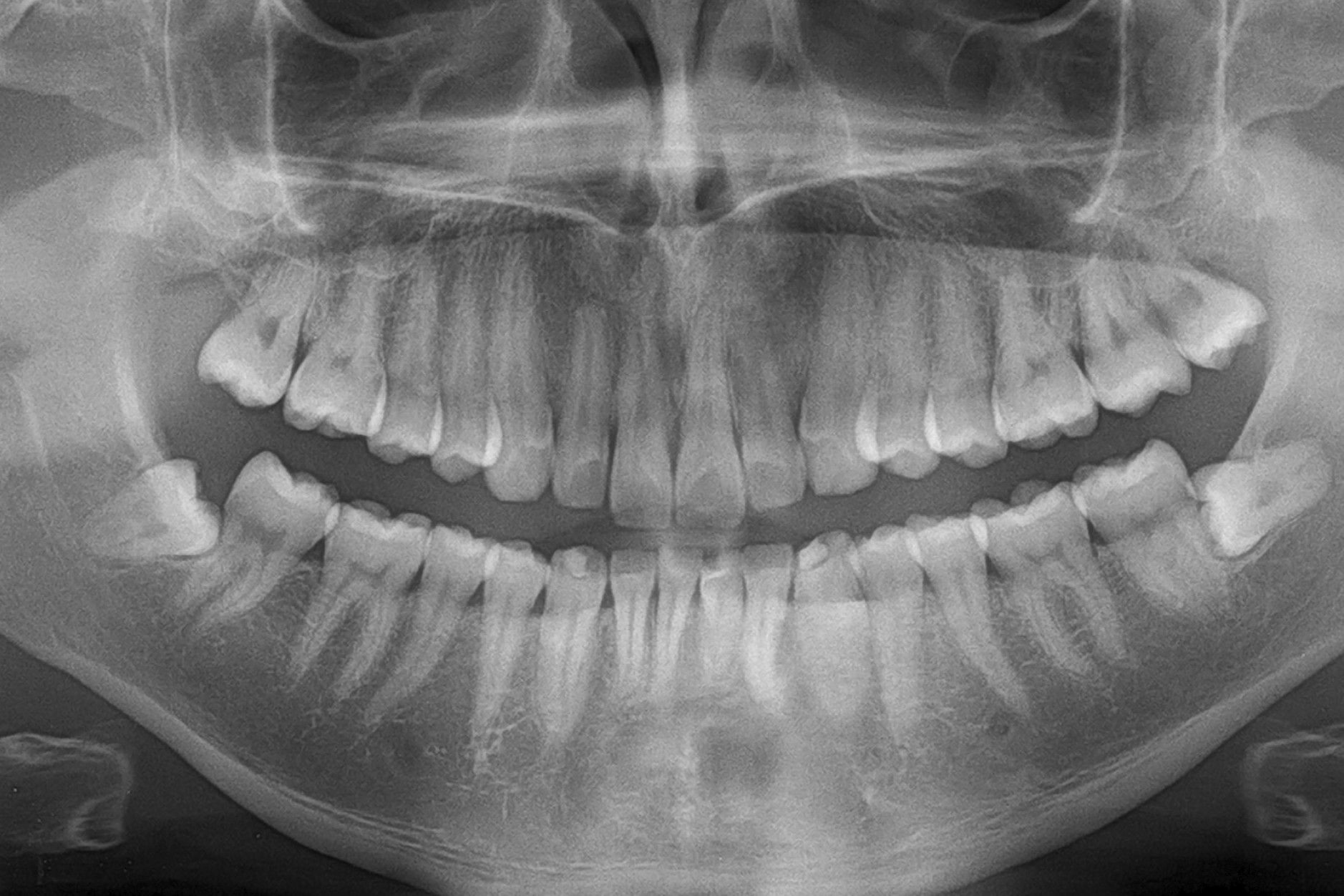 29 Fakta Om Radiologi
